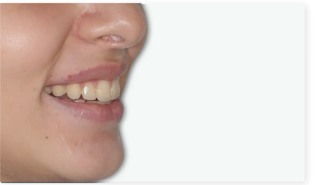 Orthodontie guidée par le visage à Alger – Centre SmileHARMONY