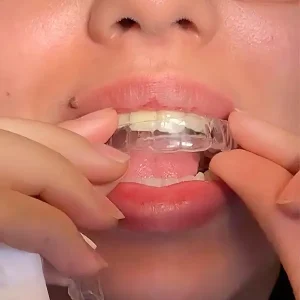 patiente adultant mettant en place des aligneurs invisibles à SmileHARMONYalger