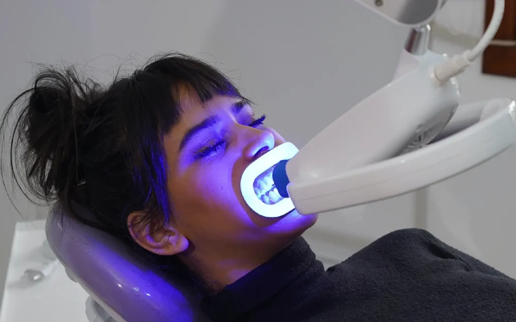eclaircissement dentaire à la clinique SmileHARMONY à alger