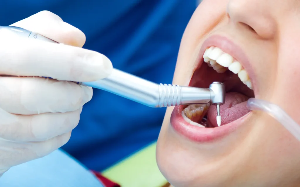 Dentiste pratique un soin dentaire sur une patiente