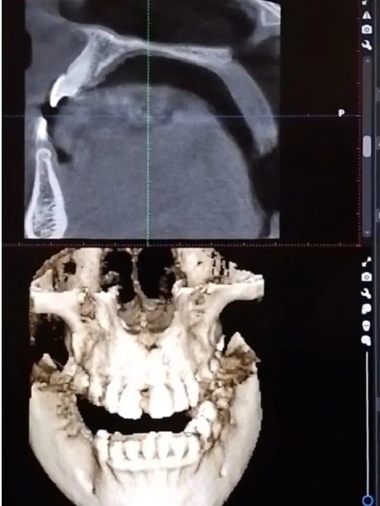 L'imagerie numérique à la clinique 'orthodontie SmileHARMONY à Alger
