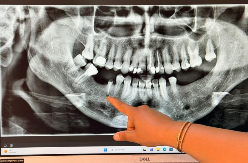 le Dr Benahmed interprétant une radiographie panoramique dentaire à la clinique SmileHARMONY